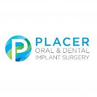 Placer Oral & Dental Implant Surgery image 1